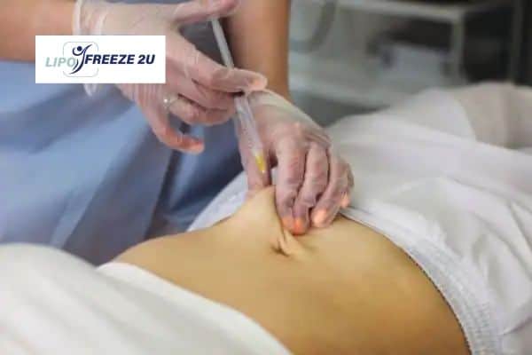 Fat Dissolving Injections Warwickshire & Weight loss medication