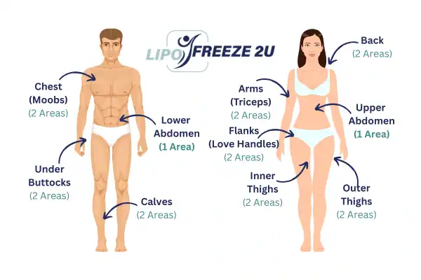 Areas you can have fat freezing treatment Warwickshire