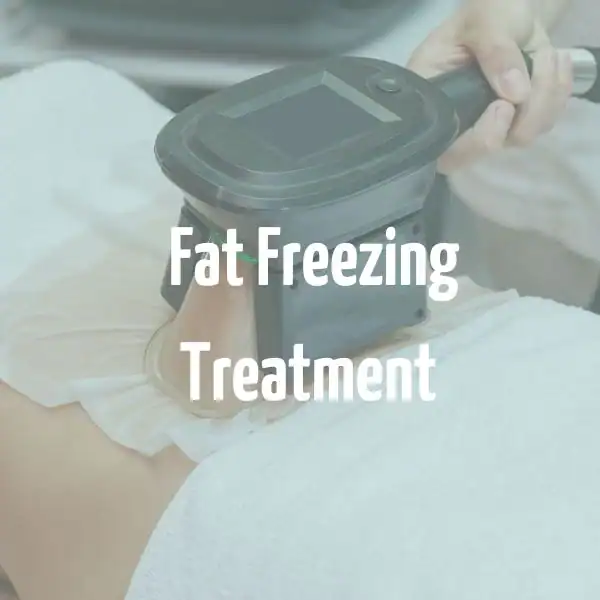 fat freezing treatment Warwickshire