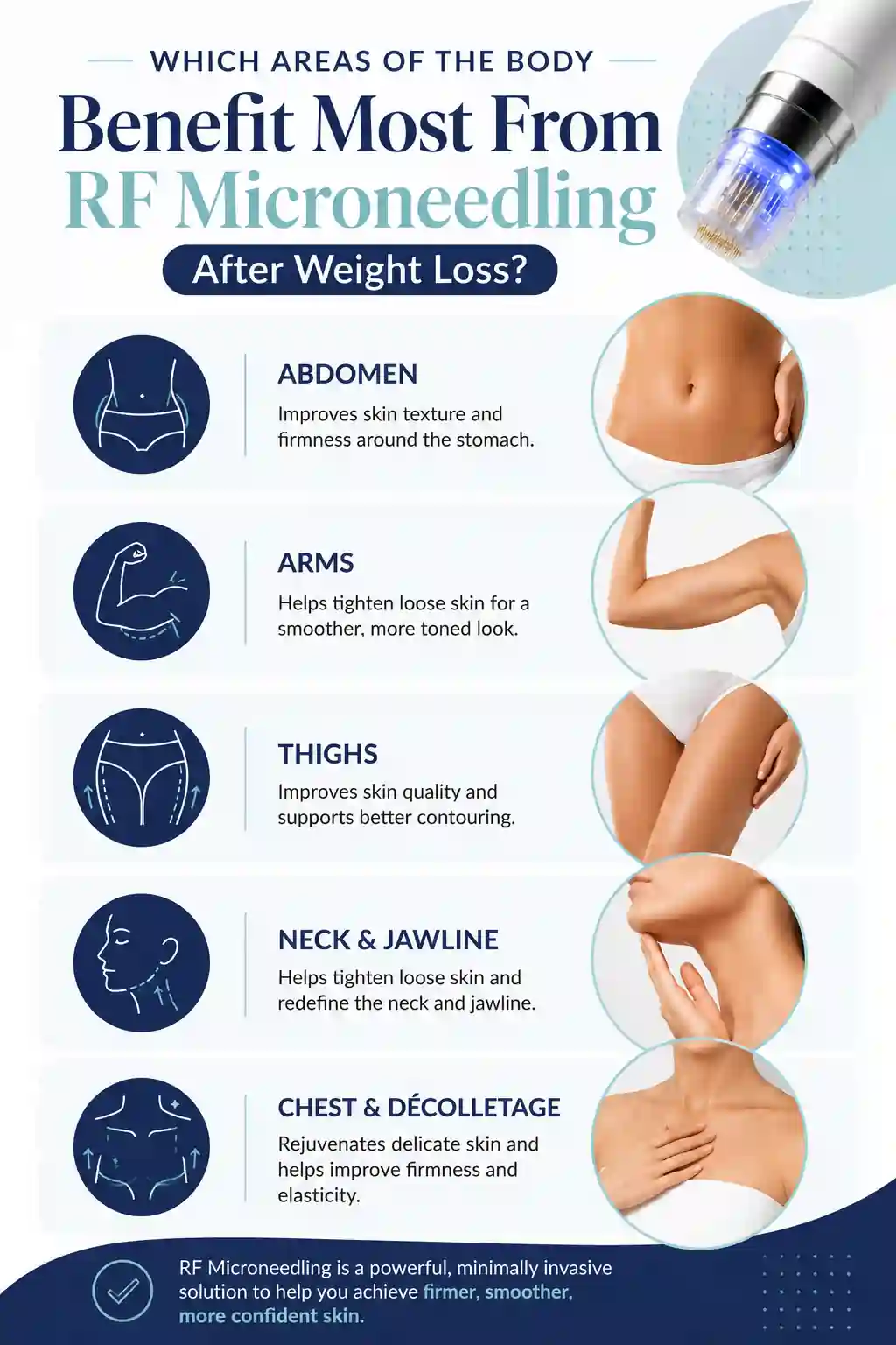 Which Areas of the Body Benefit Most From RF Microneedling After Weight Loss Warwickshire